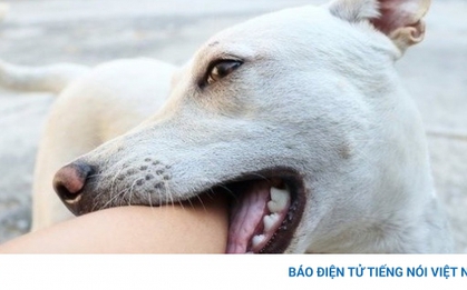 Bé gái 7 tuổi tử vong nghi bị chó dại cắn