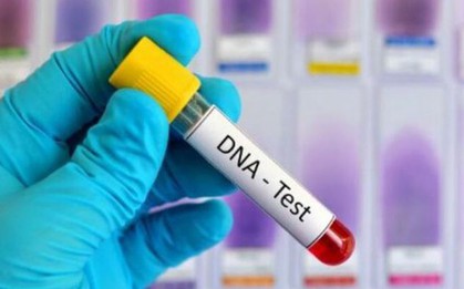 Rủ nhau đi xét nghiệm ADN, đôi bạn thân phát hiện bí mật động trời