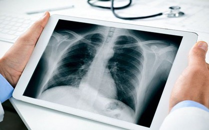 Người đàn ông Hà Nội mắc ung thư giai đoạn cuối: Sau 4 tháng làm 1 điều, 90% khối u đã biến mất