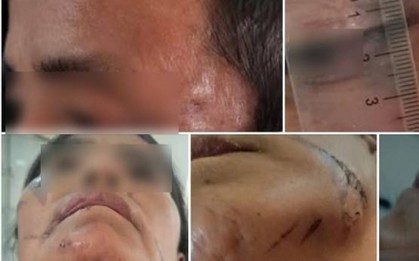 Công an Điện Biên điều tra vụ bắt giữ người trái pháp luật vì nghi bị bỏ bùa