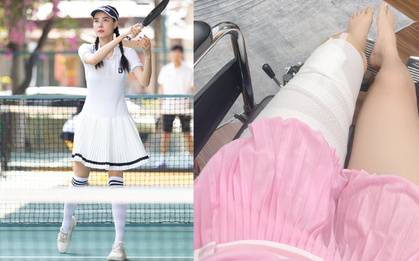 Gãy xương đùi khi chơi pickleball, Kỳ Hân vẫn chưa biết sợ, hỏi bác sĩ về ngày trở lại khiến Mạc Hồng Quân cạn lời