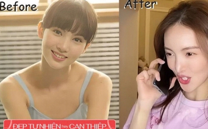 "Hoa khôi trường múa" từng được khen đẹp như tiên giáng trần nay nâng cấp thành "mỹ nhân dao kéo"