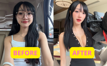 TikToker nổi tiếng công khai PTTM vòng 1: Kết quả ra sao mà fan phản ứng gay gắt, cảm thấy như bị "phản bội"?