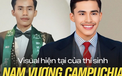 CĐM quay xe sau khi nhìn thấy diện mạo mới của thí sinh Nam vương Campuchia hậu "dao kéo", hóa ra thẩm mỹ Việt Nam đã xịn sò cỡ này!