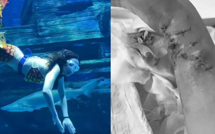 ‘Nàng tiên cá’ bị cá mập cắn tàn phế trong thủy cung