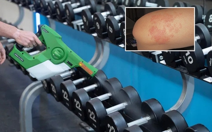 Cô gái đi tập gym vô tình chạm vào một thứ "ẩm ướt", trở về ngứa ngáy gãi đến toạc cả da