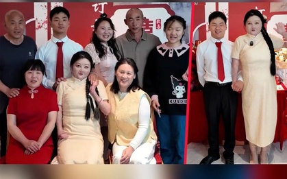 Duyên phận kỳ lạ của cô gái bỏng 95% cơ thể với người chồng sinh cùng ngày
