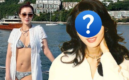 "Hoa hậu đẹp nhất" cũng phải nhờ đến "dao kéo" để tìm sự hoàn hảo, thay đổi một vị trí nâng cao tầm nhan sắc