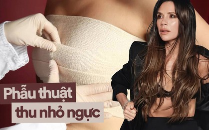 Sao Hollywood thu nhỏ ngực để quyến rũ và nổi tiếng - Khi phụ nữ hiện đại muốn "gọn lại cho đẹp hơn"