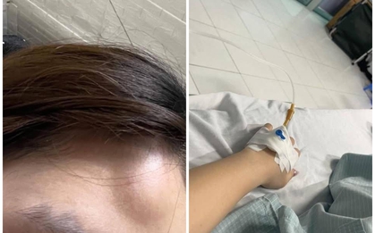 Vụ nữ sinh bị đồng nghiệp hành hung nhập viện vì mâu thuẫn "tiền tip": Phía nhà hàng nói gì?