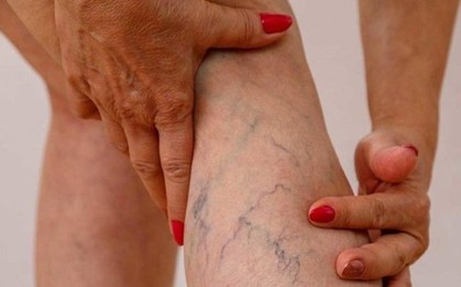 Căn bệnh cực kỳ nguy hiểm 1/3 người Việt trưởng thành có nguy cơ mắc, diễn biến âm thầm khó biết