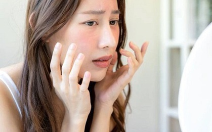 2 sai lầm kinh điển khi chọn mua kem chống nắng khiến da sạm nám, lão hóa nhanh