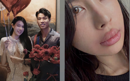 Xuất hiện với đôi môi sưng vù, bạn gái gia thế “trâm anh thế phiệt” của hậu vệ Văn Thanh phẫu thuật thẩm mỹ?