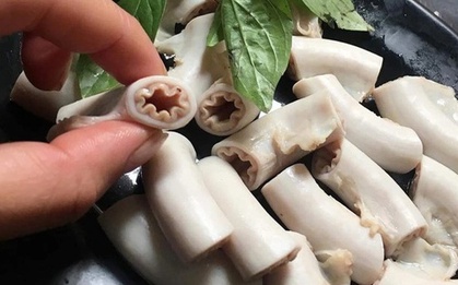 Bác sĩ cảnh báo 5 nhóm bệnh lý nguy hiểm, càng ăn lòng se điếu bệnh sẽ càng nặng hơn