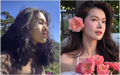 Yên Đan - “công chúa của SOOBIN”: Ngỡ ngàng diện mạo trước khi phẫu thuật