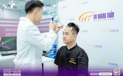 Diễn viên “Phố trong làng” đi cấy tóc: Ngủ một giấc tỉnh dậy, trán hói chữ M “bay màu”, trẻ ra vài tuổi