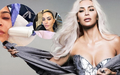 Sao Hollywood chi gần 120.000.000VNĐ/lần "bơm" collagen, không ngớt lời ca ngợi đây là phương pháp giúp săn chắc da bậc nhất