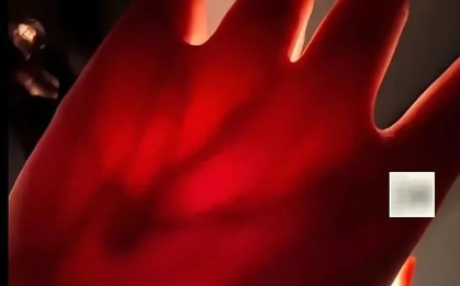 Cô gái đăng ảnh mình chiếu đèn pin vào tay, cư dân mạng phát hiện điều bất ổn