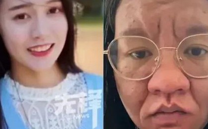 Người phụ nữ gây sốc vì gương mặt như bà lão khi mang thai