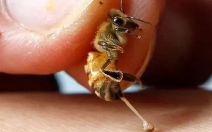 Dùng ong đốt để điều trị ung thư, người phụ nữ phải cắt bỏ cả hai bên ngực