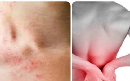 Những triệu chứng suy thận nhẹ bạn cần biết