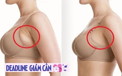 Phụ nữ sau tuổi 40 có nhiều mỡ nách chỉ cần 1 chiếc dây để thực hiện 6 động tác: Đảm bảo sớm gọn đẹp như được hút mỡ nách