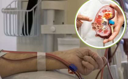 Người trẻ bị suy thận ngày càng cao: “Nằm lòng” 3 lời khuyên từ bác sĩ để dự phòng sớm căn bệnh này!