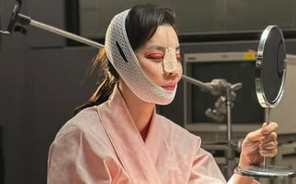 Mỹ nhân Giày Thủy Tinh gây sốc với gương mặt sưng tấy đáng sợ, băng bó kín mít