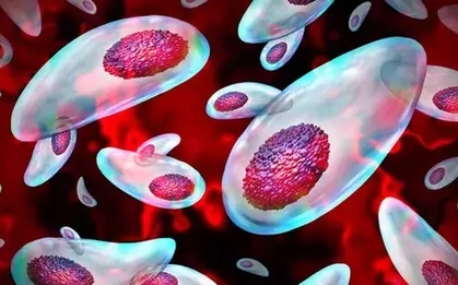 Một loại ký sinh có thể cắt đứt tinh trùng của con người, nguyên nhân gây vô sinh toàn cầu?