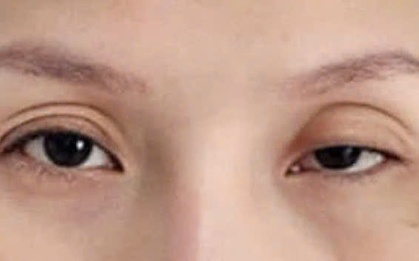 Cô gái 22 tuổi cả khi ngủ mắt cũng không thể nhắm kín vì "60 phút định mệnh..."