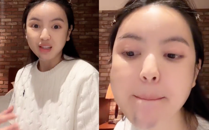 Chu Thanh Huyền kể lại trải nghiệm kinh hoàng khi đi xử lý hậu quả phẫu thuật thẩm mỹ