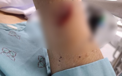 2 phụ nữ chém nhau bị thương nặng vì ghen tuông ở Thái Bình: Hé lộ tình trạng hôn nhân phức tạp