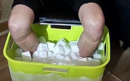 Nam sinh viên phải cắt cụt chân sau 10 tiếng ngâm đá khô, hé lộ âm mưu "động trời"