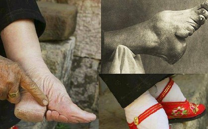 Cô gái 15 tuổi lấy chồng giàu nhờ "gót sen ba tấc" nhưng cái giá phải trả là thanh xuân bị bóp nghẹt đau đớn