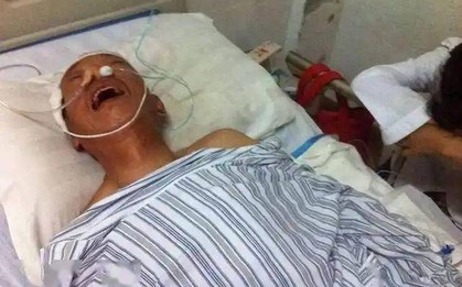 Ngày càng nhiều người tử vong vì nhồi máu não? Bác sĩ khuyên: Uống nước nóng còn hơn ăn 4 thứ này