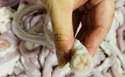 Người phụ nữ bán lòng lợn nhiễm liên cầu khuẩn