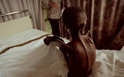 Mỗi phút, thêm một người chết vì HIV/AIDS