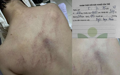"Giáo viên hay kẻ ác nhân mà đánh trẻ không biết ghê tay"