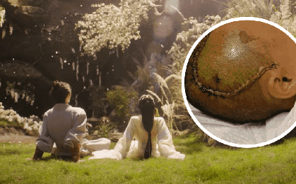 MXH náo loạn vì 1 nữ diễn viên bị tai nạn đến mất trí nhớ, 10 tháng đau đớn tưởng chết chẳng ai hay