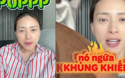Mẹ bầu Ngô Thanh Vân gặp một tình trạng "vô cùng khó chịu" trong thai kỳ: Ngứa khủng khiếp nhưng vẫn thấy mừng vì 1 điều