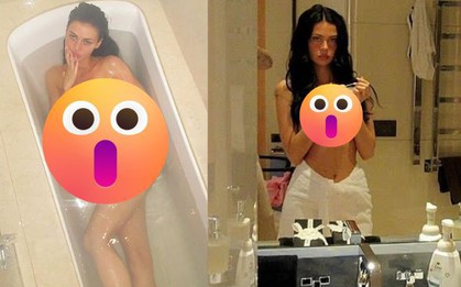 Dâu cả nhà Beckham gây sốc khi tung ảnh bán nude giữa lúc 'cạch mặt' nhà chồng