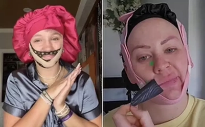 Chuyên gia báo nguy về kiểu làm đẹp cực đoan, hành xác của gen Z