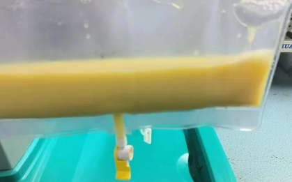 Người đàn ông 34 tuổi "máu trắng đục như mỡ lợn" vì loại đồ uống nhiều người thích mê