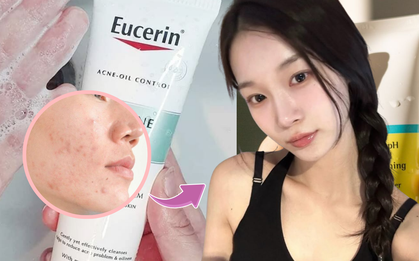Top 7 sữa rửa mặt cho da dầu mụn, giá bình dân nhưng dùng phải thốt lên là ĐỈNH!