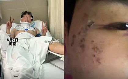 Nằm mơ mình bị rượt đuổi, thanh niên lao từ cửa sổ tầng 3 xuống đất mà không hề hay biết