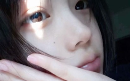 KIỂM TRA NGAY: Nốt ruồi mọc ở 6 vị trí này trên cơ thể rất dễ "biến hình" thành ung thư!