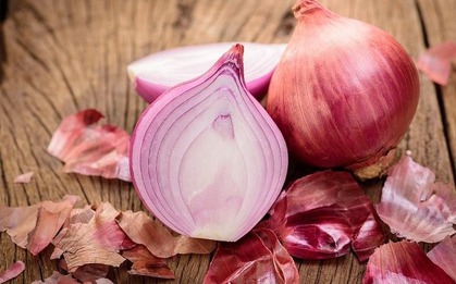 Sống mấy chục năm mới biết hành tây làm được 5 việc này, ai không biết thì rất thiệt