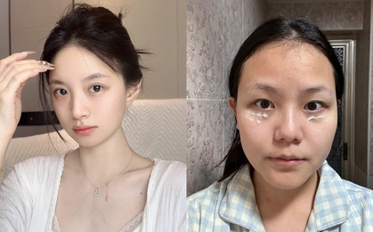 5 tuýp kem mắt dưới 400k nhận được đánh giá 4,9/5* từ nhiều người dùng