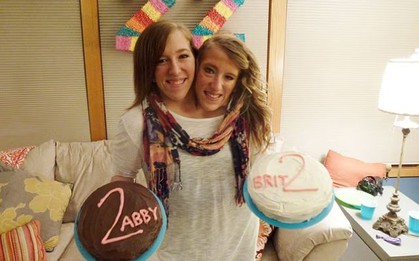 Cặp song sinh dính liền nổi tiếng thế giới được cho là đã có em bé: Họ có thể sinh con như thế nào?