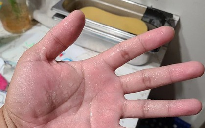 Dù giữa mùa hè, đổ mồ hôi nhiều ở 4 bộ phận này thì... trong người đầy bệnh!
